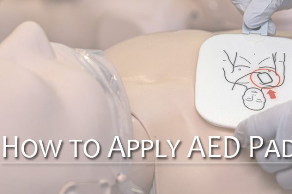 AED垫放置技巧