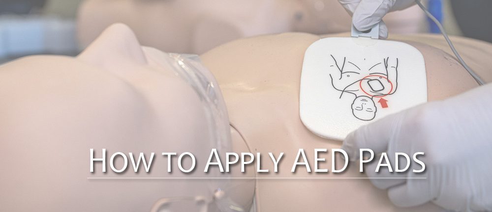 AED垫放置技巧